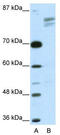 SPIN antibody, TA329689, Origene, Western Blot image 