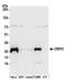 Cysteine Rich Protein 2 antibody, A305-613A-M, Bethyl Labs, Western Blot image 