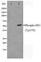 Hematopoietic Cell-Specific Lyn Substrate 1 antibody, TA348441, Origene, Western Blot image 