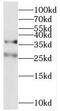 Mitochondrial Fission Factor antibody, FNab05148, FineTest, Western Blot image 