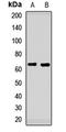 Internexin Neuronal Intermediate Filament Protein Alpha antibody, LS-C668894, Lifespan Biosciences, Western Blot image 