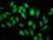 BRISC And BRCA1 A Complex Member 2 antibody, LS-C680195, Lifespan Biosciences, Immunofluorescence image 