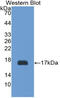 Glycoprotein Ib Platelet Subunit Beta antibody, abx129336, Abbexa, Western Blot image 