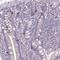 RUN Domain Containing 3B antibody, NBP2-31661, Novus Biologicals, Immunohistochemistry paraffin image 