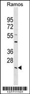 Lysophospholipase 2 antibody, 59-466, ProSci, Western Blot image 