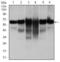 Keratin 5 antibody, MA5-17057, Invitrogen Antibodies, Western Blot image 