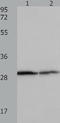 Tyrosine 3-Monooxygenase/Tryptophan 5-Monooxygenase Activation Protein Beta antibody, TA322854, Origene, Western Blot image 