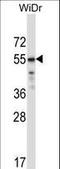 Transcription Factor CP2 Like 1 antibody, LS-C161820, Lifespan Biosciences, Western Blot image 