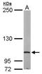 Eukaryotic Translation Initiation Factor 4 Gamma 2 antibody, NBP1-31469, Novus Biologicals, Western Blot image 