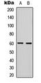 Programmed Cell Death 4 antibody, LS-C356249, Lifespan Biosciences, Western Blot image 