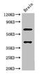Leucine Rich Repeat Transmembrane Neuronal 4 antibody, orb46427, Biorbyt, Western Blot image 