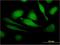Late Endosomal/Lysosomal Adaptor, MAPK And MTOR Activator 5 antibody, H00010542-M12, Novus Biologicals, Immunocytochemistry image 