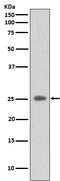C-Reactive Protein antibody, M00249, Boster Biological Technology, Western Blot image 