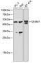 Sperm Adhesion Molecule 1 antibody, GTX54679, GeneTex, Western Blot image 