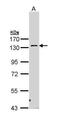 Serine/threonine-protein kinase N2 antibody, TA308478, Origene, Western Blot image 