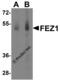 Fasciculation and elongation protein zeta-1 antibody, 4265, ProSci Inc, Western Blot image 