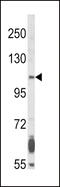 Fibroblast growth factor receptor 2 antibody, 63-087, ProSci, Western Blot image 