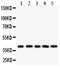 Major Histocompatibility Complex, Class I, C antibody, LS-C357562, Lifespan Biosciences, Western Blot image 
