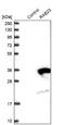 RAB23, Member RAS Oncogene Family antibody, NBP1-86367, Novus Biologicals, Western Blot image 
