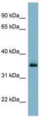 GTP Binding Protein Overexpressed In Skeletal Muscle antibody, TA346398, Origene, Western Blot image 