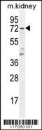 Thromboxane A Synthase 1 antibody, 56-215, ProSci, Western Blot image 