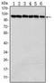 Poly(ADP-Ribose) Polymerase 1 antibody, TA318859, Origene, Western Blot image 