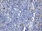 Inducible T Cell Costimulator Ligand antibody, LS-C799249, Lifespan Biosciences, Immunohistochemistry paraffin image 
