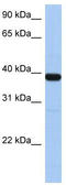 Zinc Finger Protein 781 antibody, TA339808, Origene, Western Blot image 