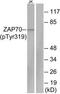 Zeta Chain Of T Cell Receptor Associated Protein Kinase 70 antibody, TA313217, Origene, Western Blot image 