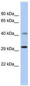 ADP Ribosylation Factor Like GTPase 14 Effector Protein antibody, TA338814, Origene, Western Blot image 