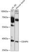 Centromere Protein N antibody, 18-077, ProSci, Western Blot image 