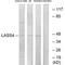 LAG1 longevity assurance homolog 4 antibody, PA5-49881, Invitrogen Antibodies, Western Blot image 