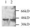 Dual specificity mitogen-activated protein kinase kinase 3 antibody, PA1-28434, Invitrogen Antibodies, Western Blot image 