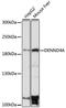 DENN Domain Containing 4A antibody, A11173, Boster Biological Technology, Western Blot image 