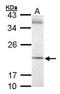 SEC61 Translocon Gamma Subunit antibody, GTX101782, GeneTex, Western Blot image 