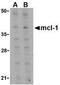 MCL1 Apoptosis Regulator, BCL2 Family Member antibody, TA306207, Origene, Western Blot image 