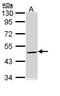 Keratin 20 antibody, TA308803, Origene, Western Blot image 
