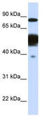 Nexilin F-Actin Binding Protein antibody, TA346500, Origene, Western Blot image 