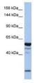 Erythrocyte Membrane Protein Band 4.1 Like 2 antibody, NBP1-56763, Novus Biologicals, Western Blot image 