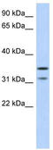 Elongator Acetyltransferase Complex Subunit 5 antibody, TA335596, Origene, Western Blot image 