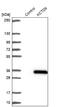 Potassium Channel Tetramerization Domain Containing 6 antibody, NBP1-81562, Novus Biologicals, Western Blot image 