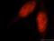 Proteasome activator complex subunit 3 antibody, 14907-1-AP, Proteintech Group, Immunofluorescence image 