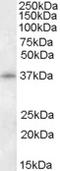 Cyclin-dependent kinase 10 antibody, TA305909, Origene, Western Blot image 