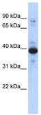 Ring Finger Protein 34 antibody, TA345656, Origene, Western Blot image 