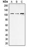 Endoplasmic Reticulum Aminopeptidase 1 antibody, LS-C353472, Lifespan Biosciences, Western Blot image 