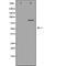 Chloride Voltage-Gated Channel 5 antibody, orb229596, Biorbyt, Western Blot image 