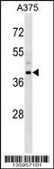 Snurportin-1 antibody, 58-602, ProSci, Western Blot image 