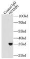 OCIA Domain Containing 1 antibody, FNab05958, FineTest, Immunoprecipitation image 
