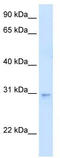 LIM Domain Binding 3 antibody, TA346123, Origene, Western Blot image 