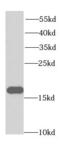 Eukaryotic translation initiation factor 5A-1 antibody, FNab02728, FineTest, Western Blot image 